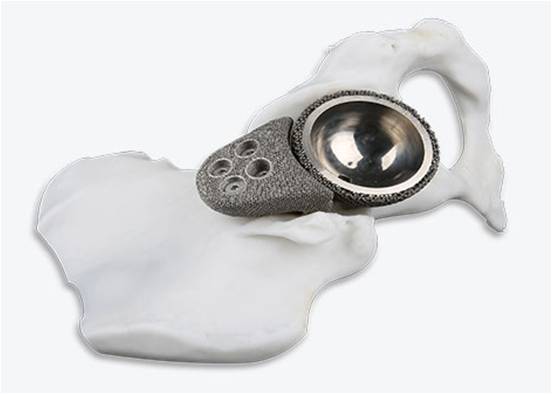 Success Stories-ELECTRON BEAM FORMING PRODUCTS